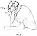 Fig. 04 - Head support device
