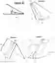 Fig. 11 - Sheets and Coverings Retaining Device