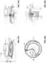 Fig. 27 - Unit of a coffee apparatus having a bean container, a portioning device and a grinder