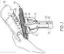 Fig. 03 - Sponge mop