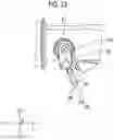 Fig. 26 - Endoscope