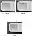Fig. 05 - Intraoral scanner sleeve authentication and identification
