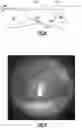 Fig. 07 - Digital otoscope