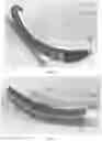Fig. 06 - Laryngoscope system and blade assembly