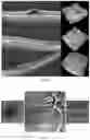 Fig. 07 - Optical coherence tomography imaging systems, handheld probes, and methods that use a field curvature to match a curved surface of tissue