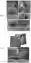 Fig. 08 - Optical coherence tomography imaging systems, handheld probes, and methods that use a field curvature to match a curved surface of tissue