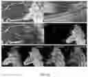 Fig. 09 - Optical coherence tomography imaging systems, handheld probes, and methods that use a field curvature to match a curved surface of tissue