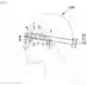 Fig. 02 - Device for the determination and analysis of the motor skill and the oculomotor skill of a person