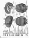 Fig. 08 - MEDICAL IMAGE PROCESSING SYSTEM AND METHOD FOR PERSONALIZED BRAIN DISEASE DIAGNOSIS AND STATUS DETERMINATION