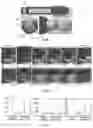 Fig. 04 - Method of photoacoustic imaging intraocular tumors including back-projection reconstruction to measure heterogeneity