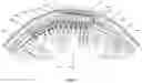 Fig. 02 - Implantable Neural Interface