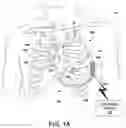 Fig. 02 - State-based atrial event detection