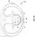 Fig. 04 - State-based atrial event detection