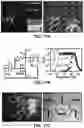 Fig. 103 - FLEXIBLE AND STRETCHABLE ELECTRONIC SYSTEMS FOR EPIDERMAL ELECTRONICS