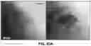 Fig. 115 - FLEXIBLE AND STRETCHABLE ELECTRONIC SYSTEMS FOR EPIDERMAL ELECTRONICS
