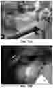 Fig. 23 - FLEXIBLE AND STRETCHABLE ELECTRONIC SYSTEMS FOR EPIDERMAL ELECTRONICS
