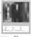 Fig. 31 - FLEXIBLE AND STRETCHABLE ELECTRONIC SYSTEMS FOR EPIDERMAL ELECTRONICS