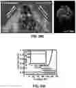 Fig. 40 - FLEXIBLE AND STRETCHABLE ELECTRONIC SYSTEMS FOR EPIDERMAL ELECTRONICS