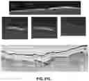 Fig. 75 - FLEXIBLE AND STRETCHABLE ELECTRONIC SYSTEMS FOR EPIDERMAL ELECTRONICS