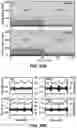 Fig. 83 - FLEXIBLE AND STRETCHABLE ELECTRONIC SYSTEMS FOR EPIDERMAL ELECTRONICS