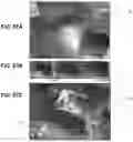 Fig. 93 - FLEXIBLE AND STRETCHABLE ELECTRONIC SYSTEMS FOR EPIDERMAL ELECTRONICS
