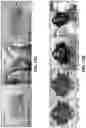 Fig. 99 - FLEXIBLE AND STRETCHABLE ELECTRONIC SYSTEMS FOR EPIDERMAL ELECTRONICS