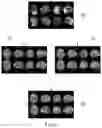Fig. 07 - Nuclear image processing method