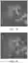 Fig. 04 - Data augmentation for training deep learning models with ultrasound images