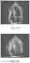 Fig. 05 - Data augmentation for training deep learning models with ultrasound images