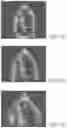 Fig. 06 - Data augmentation for training deep learning models with ultrasound images