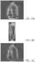Fig. 07 - Data augmentation for training deep learning models with ultrasound images