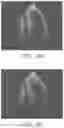Fig. 08 - Data augmentation for training deep learning models with ultrasound images