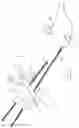 Fig. 04 - INFLATABLE PNEUMOPERITONEUM DEVICE