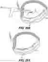 Fig. 110 - INFLATABLE PNEUMOPERITONEUM DEVICE