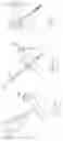 Fig. 30 - INFLATABLE PNEUMOPERITONEUM DEVICE