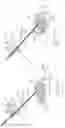 Fig. 45 - INFLATABLE PNEUMOPERITONEUM DEVICE