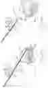 Fig. 46 - INFLATABLE PNEUMOPERITONEUM DEVICE