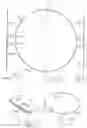 Fig. 63 - INFLATABLE PNEUMOPERITONEUM DEVICE