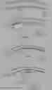 Fig. 67 - INFLATABLE PNEUMOPERITONEUM DEVICE