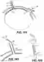 Fig. 68 - INFLATABLE PNEUMOPERITONEUM DEVICE