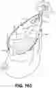 Fig. 70 - INFLATABLE PNEUMOPERITONEUM DEVICE