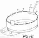 Fig. 72 - INFLATABLE PNEUMOPERITONEUM DEVICE
