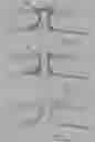 Fig. 86 - INFLATABLE PNEUMOPERITONEUM DEVICE