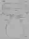 Fig. 89 - INFLATABLE PNEUMOPERITONEUM DEVICE