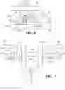 Fig. 06 - Apparatus and method for retracting brain tissue during brain surgery