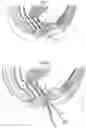 Fig. 02 - Surgical instrument