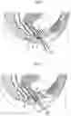Fig. 04 - Surgical instrument