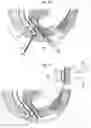 Fig. 09 - Surgical instrument