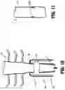 Fig. 08 - TUBULAR TISSUE REMOVAL PROCEDURE