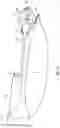 Fig. 26 - Excisional devices and methods